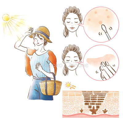 紫外線に悩む女性のイラストと肌の断面図