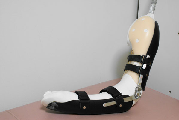 (製作途中)　上腕骨折の保持用装具。肘にロック式のダイヤル付で、角度調節が可能。