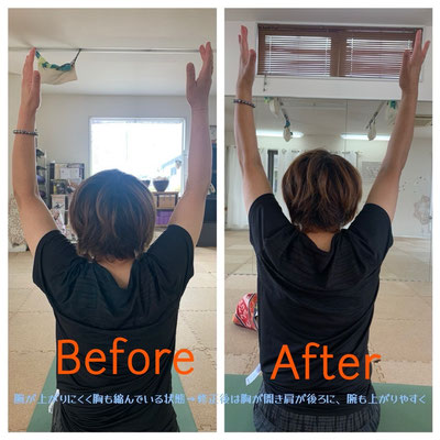腕の可動域が少なかった方