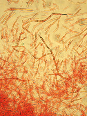 Russula vinosa Lindblad 1901 (COMMESTIBILE) Foto Emilio Pini 
