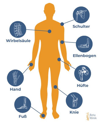 Ergotherapie bei Handgelenk- Ellenbogen- Hand-Finger-Schmerzen, Ergo-Praxis am Rhein, Ergotherapie Stein am Rhein und Berlingen, Untersee u. Rhein