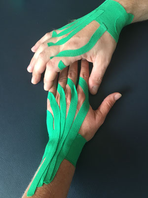 Ergotherapie Berlingen
