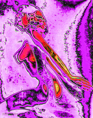 O 209