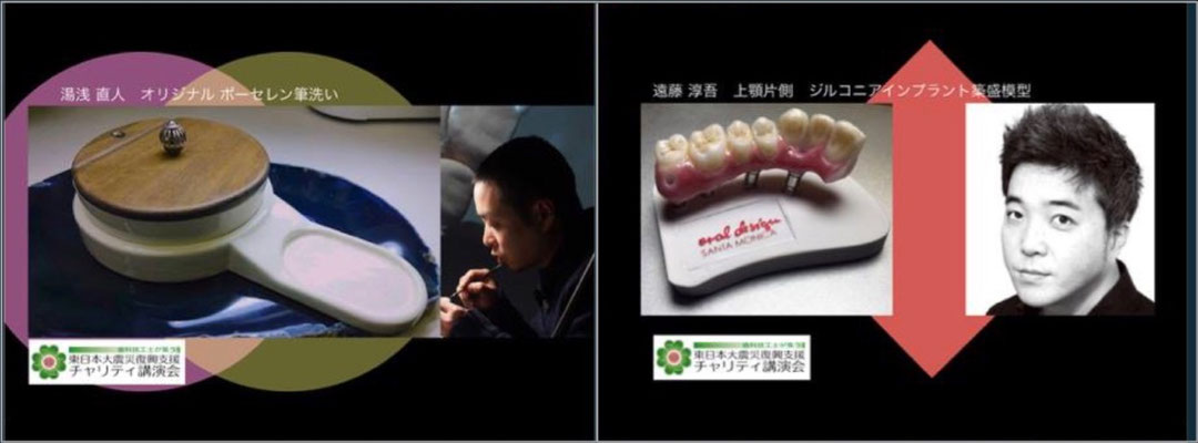  Naoto Yuasa "Original Porcelain Brush Washer Metal Ceramics Sample" / Jungo Endo "Implant superstructure with 7 teeth gum on the upper right"