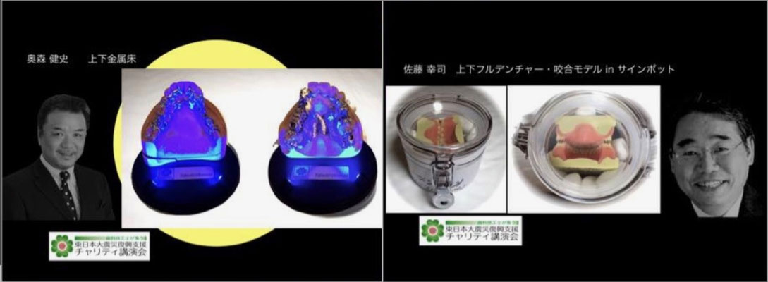 Takeshi Okumori "Upper and lower metal floor samples with illuminated exhibition stands" / Koji Sato "Upper and lower full denture occlusion model with autographed pot"