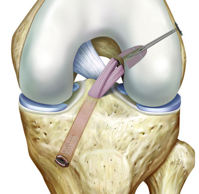 Orthopraxis Schwarzenbek Ariane Hennings Jan Orthopäde Unfallchirurgie Chirurgie Sportmedizin Akupunktur Schwerin Reinbek Lüneburg Hamburg Lübeck 
