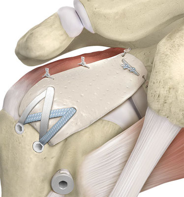 Orthopraxis Schwarzenbek Ariane Hennings Jan Orthopäde Unfallchirurgie Chirurgie Sportmedizin Akupunktur Schwerin Reinbek Lüneburg Hamburg Lübeck 