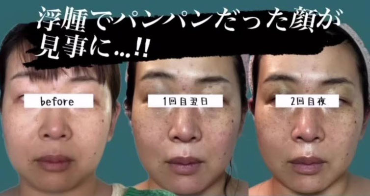 はり処 もり【ルート治療専門院】須恵町 鍼灸 - はり処 もり(旧
