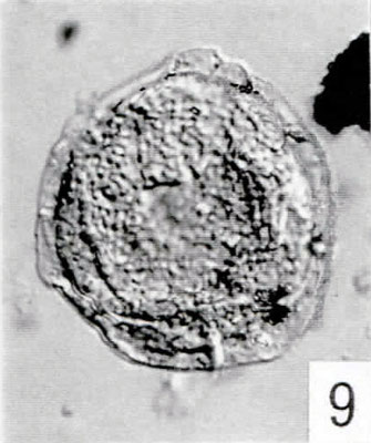 9. Inaperturopollenites sp. [Pech 1-14: 54,7/107,4] (IC)