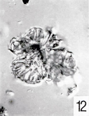 12. Botryococcus sp. [Pech 1-03: 29,0/111,1] (IC)