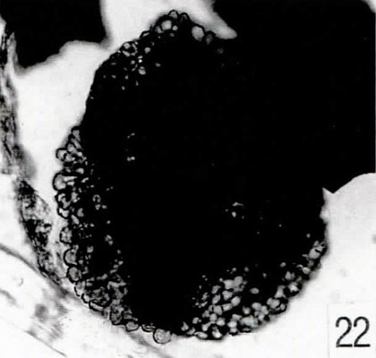 22. Ricciisporites tuberculatus [Pech 1-07: 35,9/114,6]