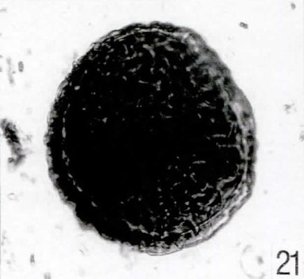 21. Lycopodiacidites rugulatus [Pech 1-05: 29,0/111,6]