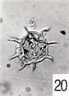 20. Micrhystridium sp. [Pech 1-02: 47,3/106,6] (IC)