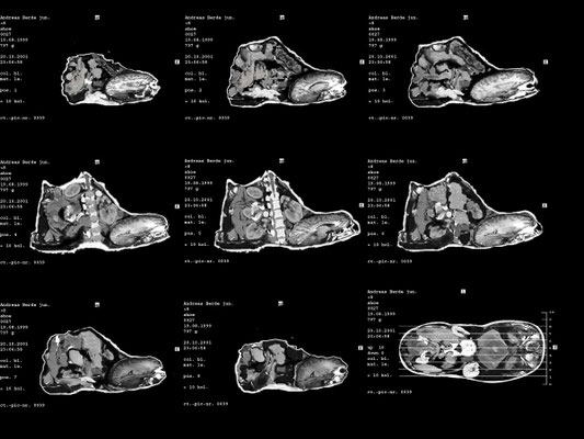 My black Shoe<br/>2002<br/>C-Print auf Folie, auf Leuchtkasten<br/>80 x 60 cm