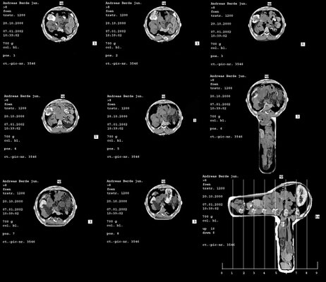 Hairdryer<br/>2002<br/>C-Print auf Folie, auf Leuchtkasten<br/>80 x 70 cm