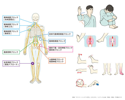 看護雑誌・オペナーシング36巻9号(2021年)挿絵