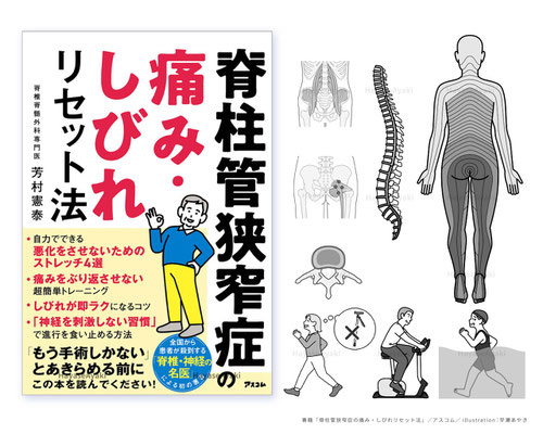 書籍「脊柱管狭窄症の痛み・しびれリセット法」カバーイラスト・挿絵