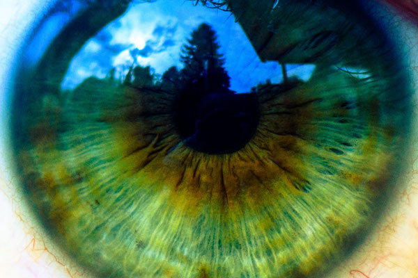 Auge / Iris