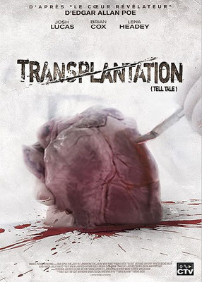 Transplantation