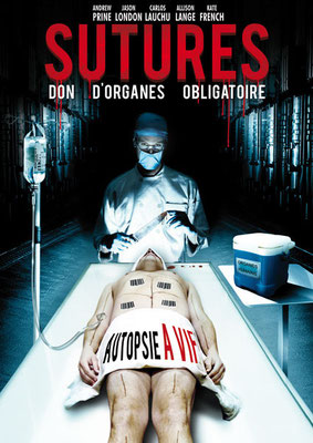Sutures