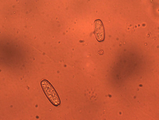 Sarcoscypha austriaca - Krulhaarkelkzwam