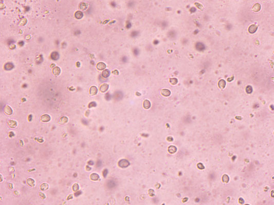 Hygrocybe pratensis - Weidewasplaat