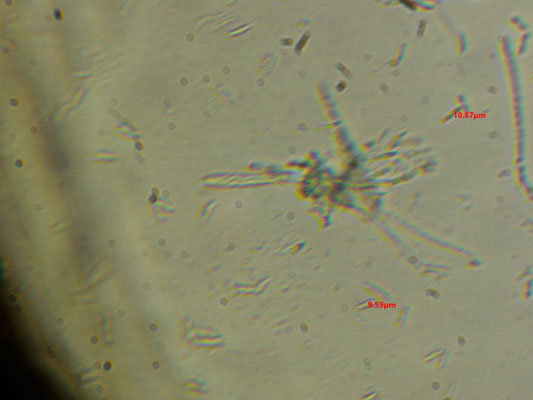Chlorociboria aeruginosa  - Grootsporige Kopergroenbekerzwam