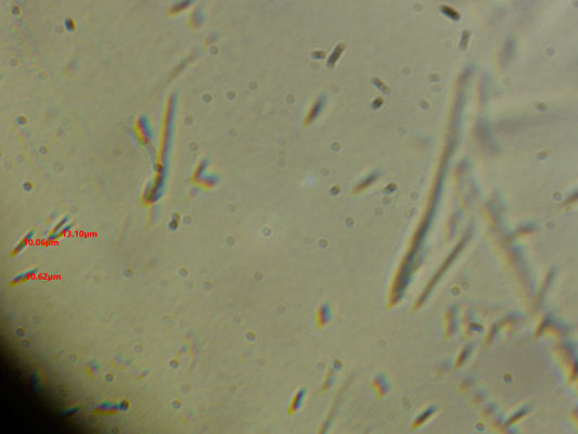 Chlorociboria aeruginosa  - Grootsporige Kopergroenbekerzwam