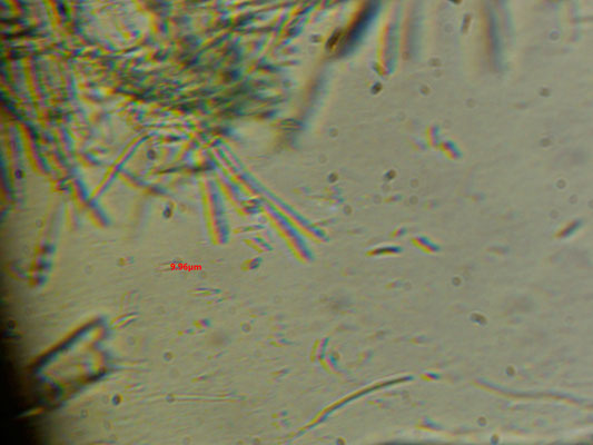Chlorociboria aeruginosa  - Grootsporige Kopergroenbekerzwam