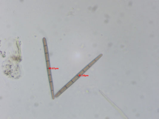 Geoglossum spec. A sensu Roobeek - Geoglossum spec. A sensu Roobeek
