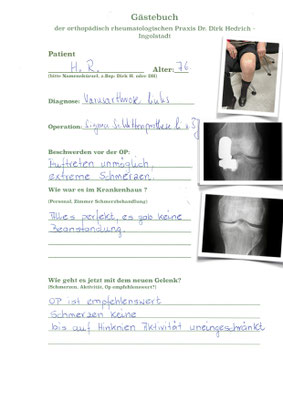 Knieverschleiß auf der Innenseite - mit Sigma Schlittenprothese versorgt