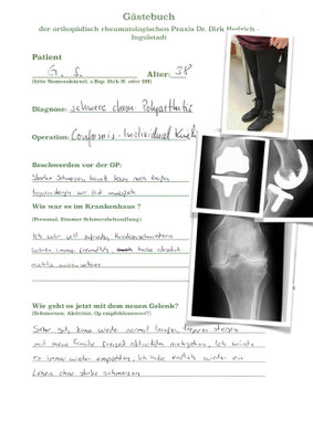 sehr junge Rheumapatientin - Auswahl einer Individualprothese mit geringem Knochenverlust und Herstellung der eigenen Anatomie