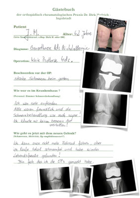 Kniegelenksverschleiß bds. mit Nickelallergie - im oberen Bild hypoallergenes Imlantat Fa Braun e Motion Titannitrit; unten NexGen Fa. Zimmer versorgt