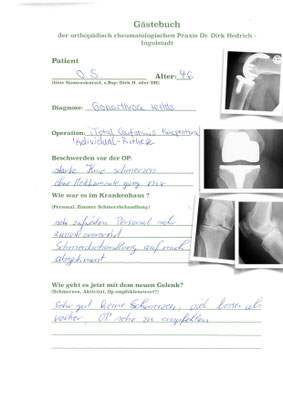 Realativ junge Frau - mehrfach voroperiert. Individual angefertigte Prothese i Uni Conformis
