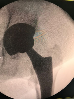 Röntgenkontrolle unter der Operation