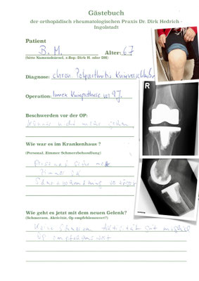 Rheumapatientin mit Osteoporose - Einzementierung der Prothese Innex Fa. Zimmer siehe auch den Befall der Finger 