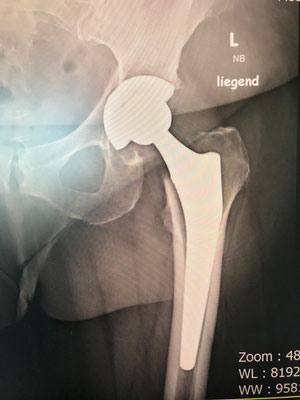 Röntgenkontrolle auf der Station