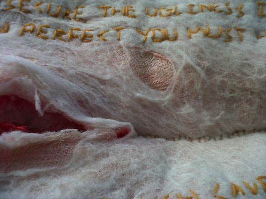 CANCER 2: MASTECTOMY Detail