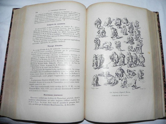Livres reliés collection médecine "La Chronique Médicale" 1897 à 1917