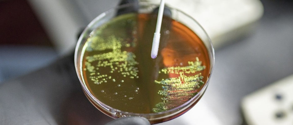 World Health Organization (WHO):  'Antimicrobial resistance (AMR) is one of the top global public health and development threats'