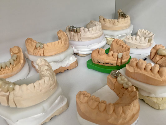 Zahnersatz Prothetik Zahnarztpraxis Werzmirzowsky