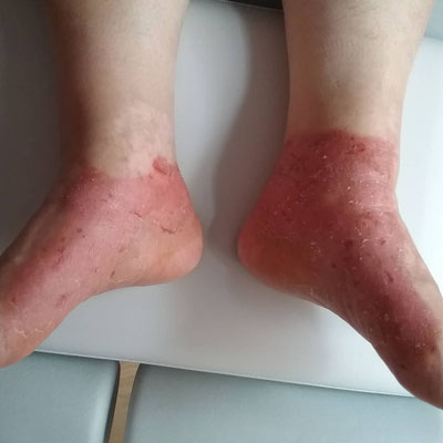 Vor Behandlung 