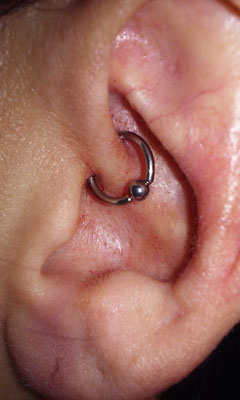 Daith (got it to help prevent migraines and says that it's working)