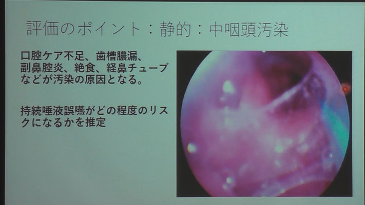 静止画像による評価のポイントを解説