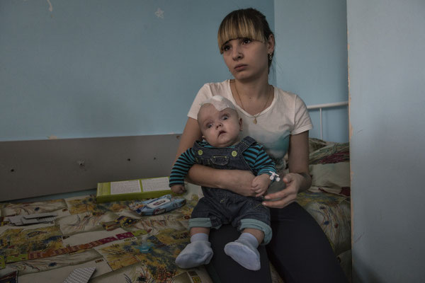 Ania, 23 years old with her daughter Roma 6 months, suffering from hydrocephalus