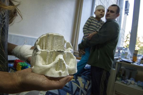 Vitali, 7 years old, he suffers from a congenital malformation called craniostenosis. Her mother is showing the mold of Vitali’s skull that is used to build the titanium plate, to develop the growth of Vitali. Pediatric clinic of neurosurgery, Kiev.