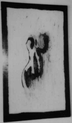 Torso. Eigene Sammlung.