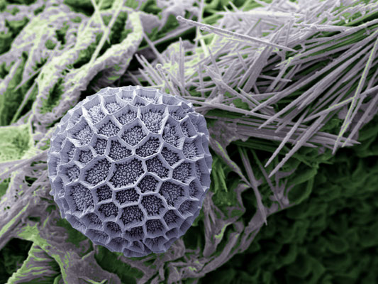 Auf der sicheren Seite - Impatiens pseudoviola, Pollen auf Staubblatt, Foto: H. Halbritter, Kolorierung: S. Ulrich, 2024, 80x60 cm, Druck auf Alu - VERKAUFT