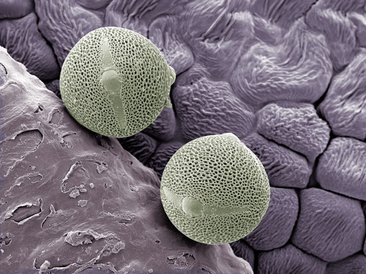 Wir zwei - Pollen von Cistus clusii - Druck auf Alu, 80x60 cm, 2015, H. Halbritter - VERKAUFT