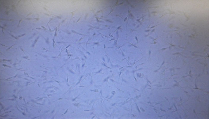 精子活性検査です